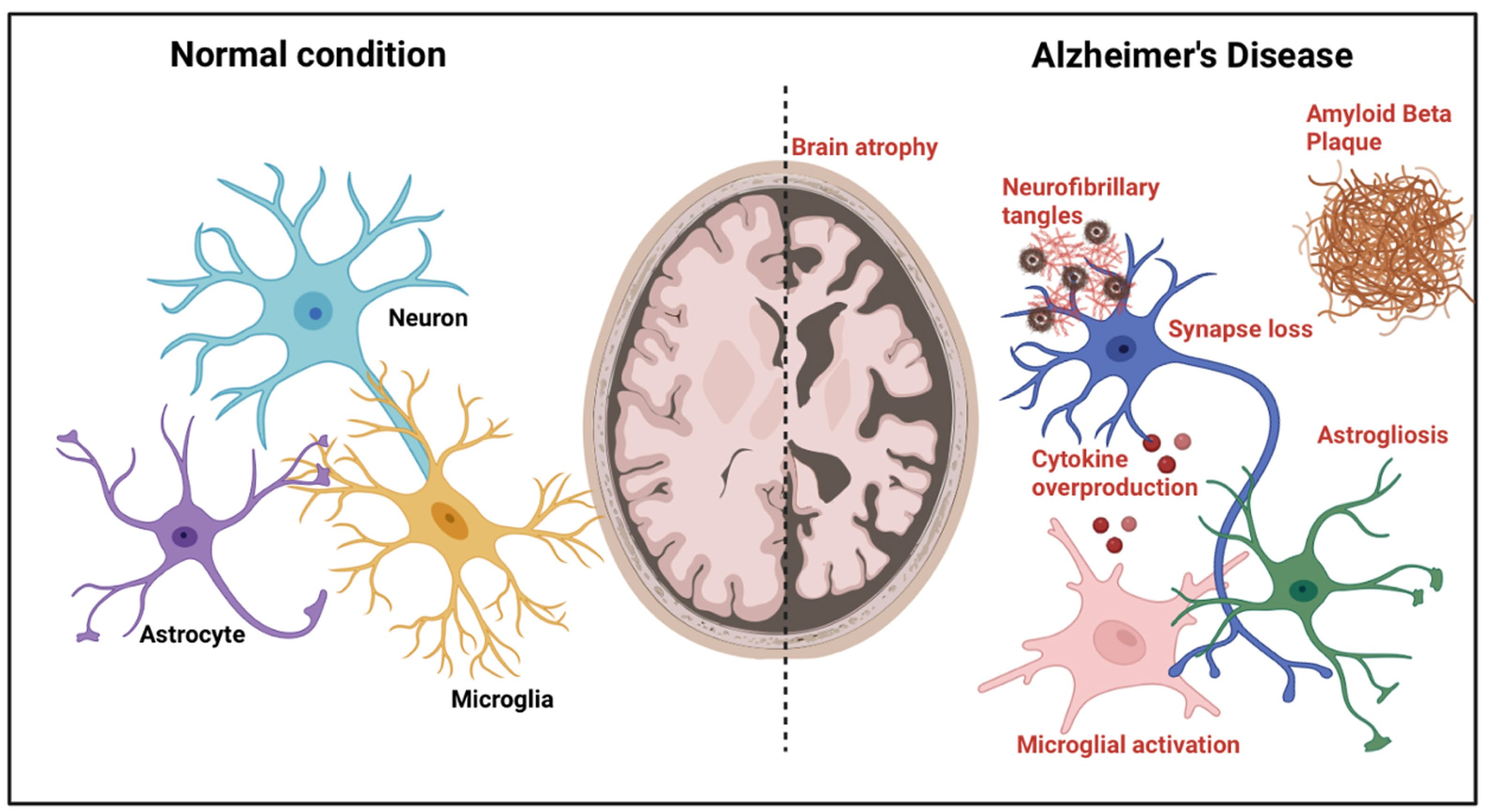 Pathological study of anti-human LILRB4 antibody in a mouse model of Alzheimer's disease